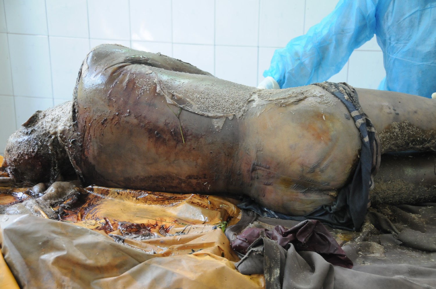 法医在黄阁浩火葬场初步验尸时的图片