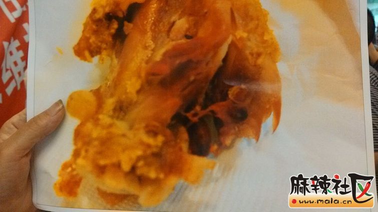 泸州佳乐广场肯德基发生食物中毒事件高清图片