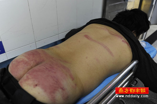 深圳小贩被暴打后扔荒郊 执法队否认打人