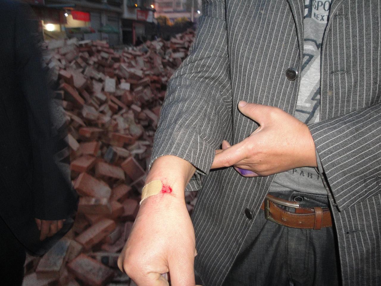 川安岳新闻:开发商强行圈地,致多人受伤,二人住院