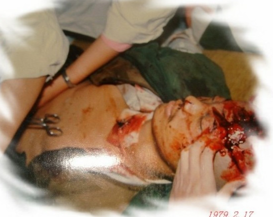 震撼越战伤亡战友. 血晕者切记,切记勿入