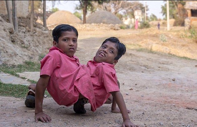 连体人的学习生活