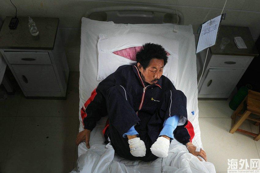 安徽一男子没钱看病 为节省药费自断双足