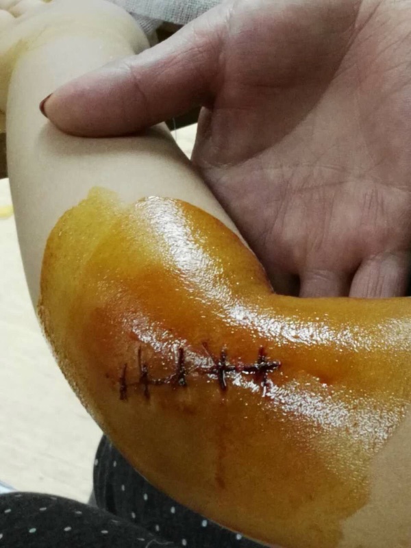 家长伤心!简阳市海上花园宝贝天空幼儿园校方如此冷漠无情.