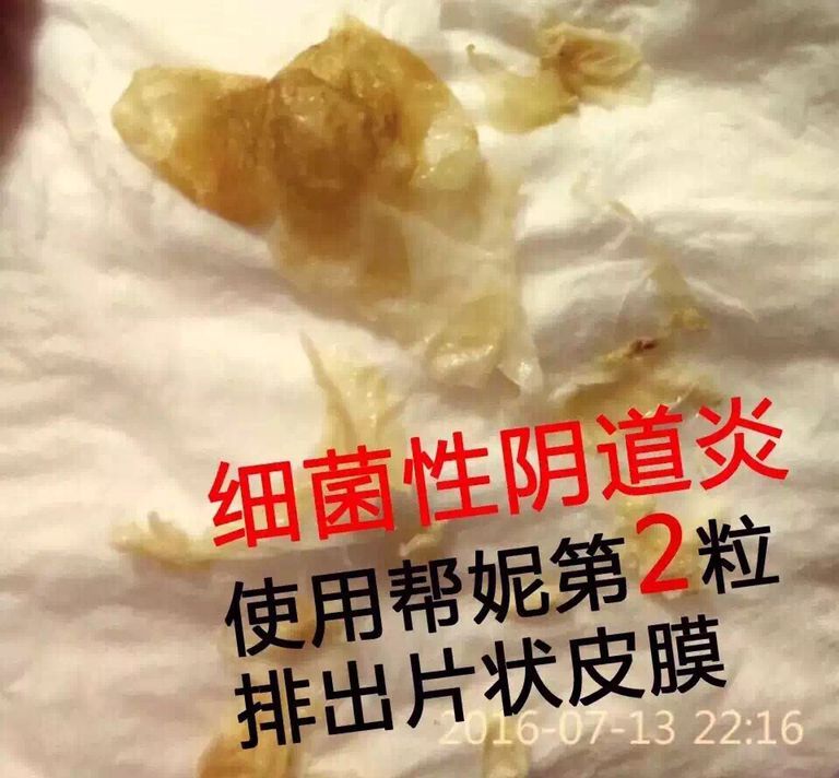 213515dqh4jfr92eyjf2gu.jpg