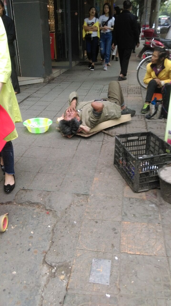 这位眼部手部都有残疾,在蓬安沿街乞讨的残疾人,真的看起来好可怜