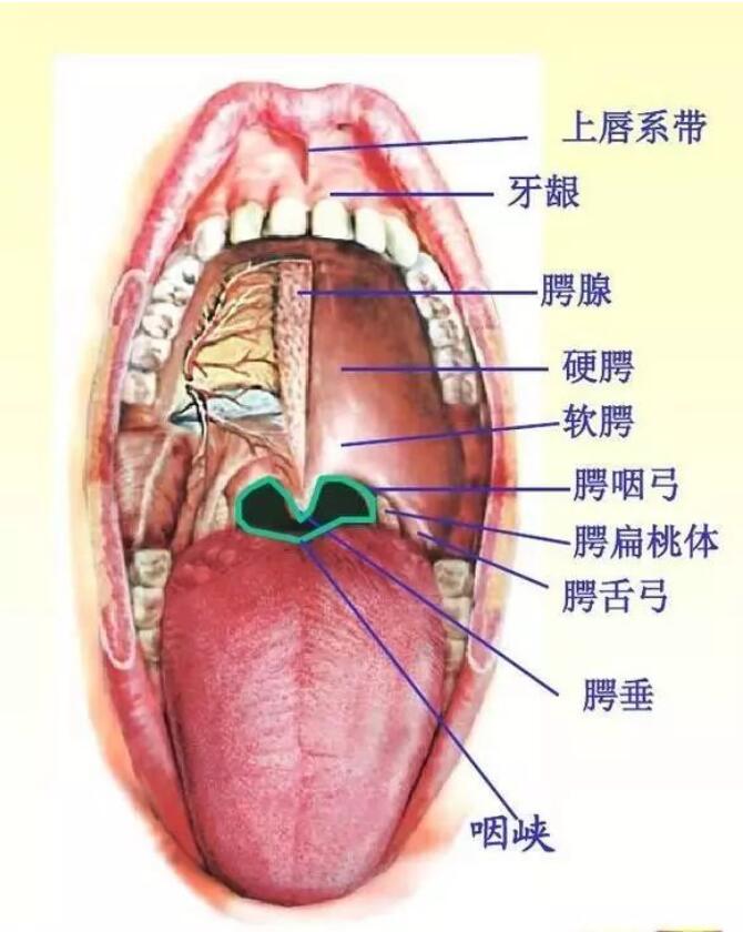 咽峡炎位置图片图片