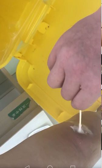 换药清创-塞药�