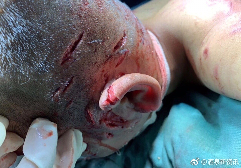男子因长期喂食流浪狗,被视为其主人,赔偿被流浪狗咬伤 .