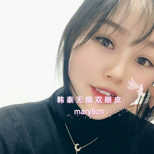 通过韩泰无痕双眼皮为你开启无龄美眸